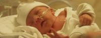  Острая асфиксия новорожденного – удушье при рождении