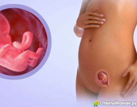 как узнать внематочную беременность