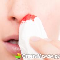 Как лечить кровотечение из носа у беременных
